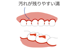 こども用LED付き電動歯ブラシアオラ（AORA）使用方法