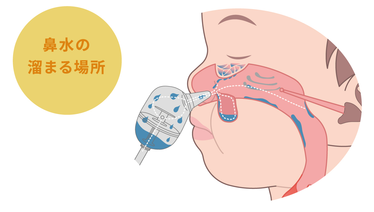 充電式電動鼻吸い器 SNOSE(スノーズ)
